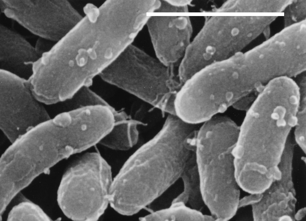 Bacteria: Gemmatimonas aurantiaca (s vyznačením délky 1 μm)